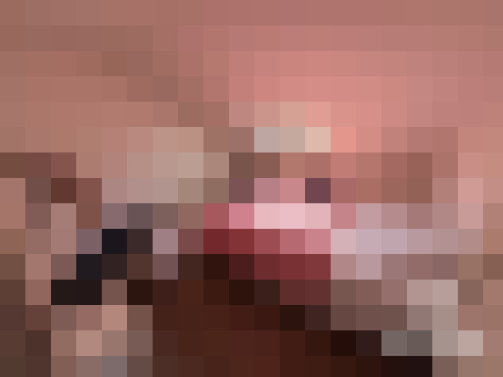  / #7