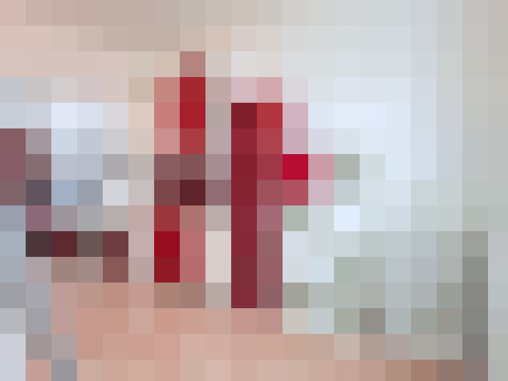  / #7