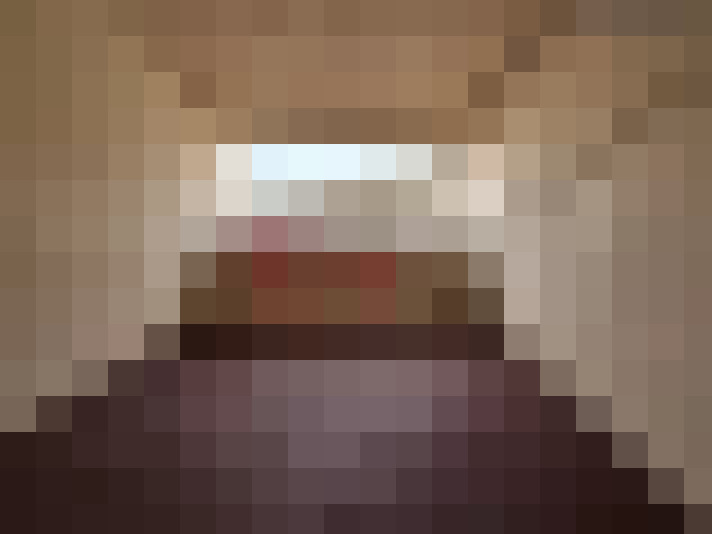  / #7