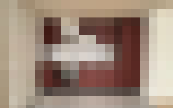  / #7